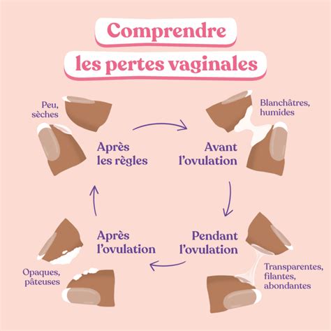 perte blanche|Pertes blanches : abondantes, épaisses, pourquoi